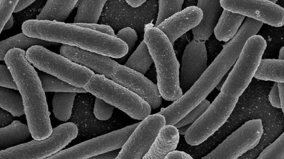 IMG: http://assets2.bigthink.com/system/slides/62/normal/EscherichiaColi_NIAIDF.jpg?1340905074